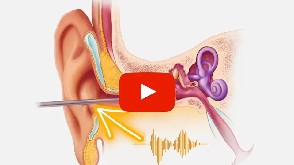 DIY Method Mutes Ear Ringing